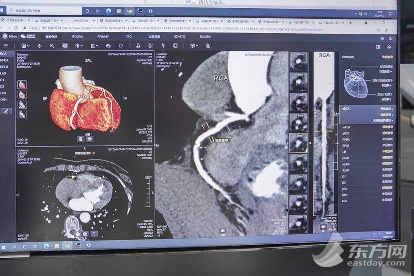 医疗数字化转型背后 那些你看不见的AI技术在提供支撑-智医疗网